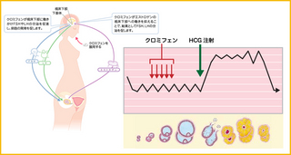 クロミフェン療法.jpg