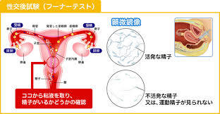 フーナーテスト.jpg