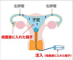 人工受精.bmp